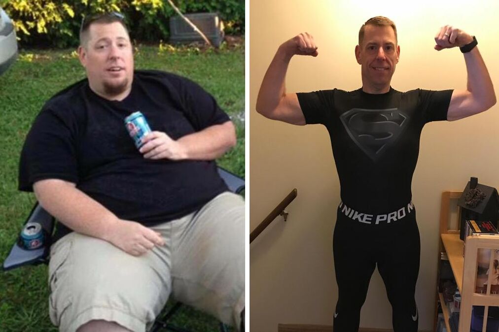 Hombre antes y después de la dieta cetogénica